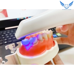 MÁY QUÉT MẪU HÀM SCAN - 3D