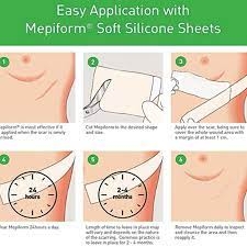 Miếng dán trị sẹo Mepiform®