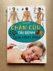 Châm Cứu Trị Bệnh Qua Hình Ảnh