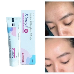 Gel Hỗ Trợ Giảm Mụn Trứng Cá và Mụn Ẩn - KLENZIT MS Gel (15g)