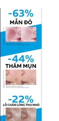 LAROCHE-POSAY Kem Dưỡng Cấp Ẩm, Làm Dịu, Phục Hồi Da - CICAPLAST ULTRA REPAIR LIGHT CREAM B5 (40ml)