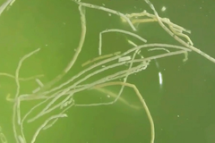 Tổng quan về Bệnh phân trắng