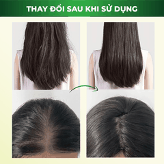 Bộ Đôi Dầu Gội NARA Mật Ong 500ML Kích Thích Mọc Tóc, Sạch Gàu, Nấm Ngứa, Loại Bỏ Dầu Thừa Và Phục Hồi Tóc Hư Tổn