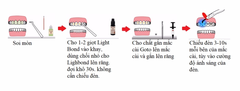 Composite gắn mắc cài GoTo_Reliance