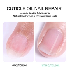 Dầu biểu bì Aliver Cuticle Oil Nail Repair hỗ trợ dưỡng chất cho móng tay mỏng dễ gãy