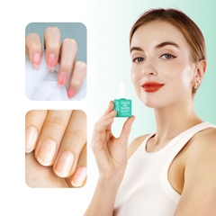 Dầu biểu bì Aliver Cuticle Oil Nail Repair hỗ trợ dưỡng chất cho móng tay mỏng dễ gãy