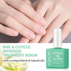 Dầu biểu bì Aliver Cuticle Oil Nail Repair hỗ trợ dưỡng chất cho móng tay mỏng dễ gãy