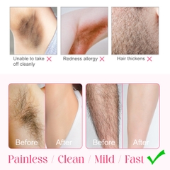 Kem tẩy lông vùng kín dành cho nữ Aliver Intimate Hair Removal Cream