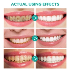 Kem đánh răng làm trắng răng Aliver hương trái cây Aliver Teeth Whitening Foaming