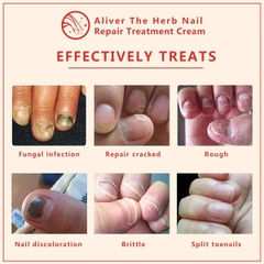 Kem dưỡng móng tay Aliver The Herb Nail Repair