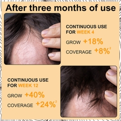 Bọt giúp mọc tóc với Biotin hỗ trợ mọc lại tóc để tóc dày Elaimei Hair Growth Foam