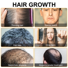 Bọt giúp mọc tóc với Biotin hỗ trợ mọc lại tóc để tóc dày Elaimei Hair Growth Foam