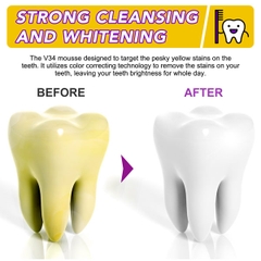 Tinh chất giúp trắng răng tự nhiên, không ê buốt Elaimei V34 Teeth Whitening Mousse