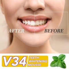 Tinh chất giúp trắng răng tự nhiên, không ê buốt Elaimei V34 Teeth Whitening Mousse