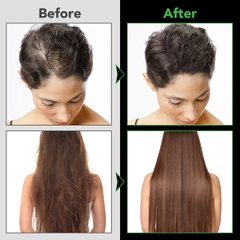 Dầu xã bổ sung biotin tăng mọc tóc sâu Aliver Jamaican Black Castor Conditioner