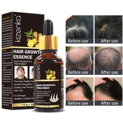 Tinh Chất Chống Rụng Tóc, Thúc Đẩy Tóc Mọc Lại Khỏe Mạnh Kizenka Hair Growth Essence