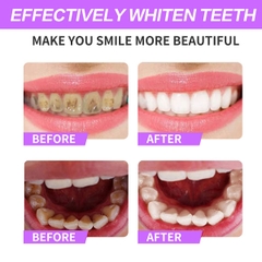 Kem làm trắng, sạch vôi răng dễ dàng Sefudun Stain Removal Whitening Toothpaste