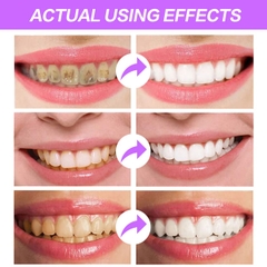 Kem làm trắng, sạch vôi răng dễ dàng Sefudun Stain Removal Whitening Toothpaste