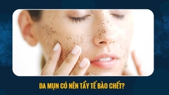 Giải đáp vấn đề: Da mụn có nên tẩy tế bào chết?