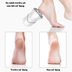 Máy tẩy da chết gót chân, loại bỏ da chết dễ dàng, không gây đau rát
