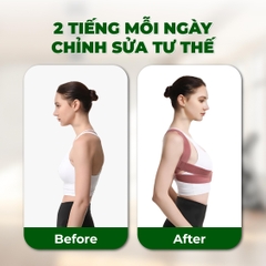 Đai Bảo Vệ Vòng 1, Đai Nâng Ngực Nữ,  Chống Gù Lưng Nam Nữ  Có Nẹp Chỉnh Cột Sống