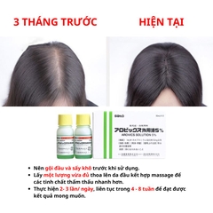 Tinh chất mọc tóc Sato Nhật Bản 30ml