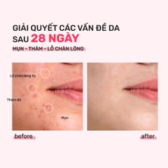 Bộ Đôi Toner Derladie 500ml, Serum Derladie Laboratoire Pore Tightening Ampoule Niacinamide 20% + Zic PCA 1% 30