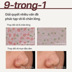 Mặt nạ đất sét Innisfree Super Volcanic Pore Clay Mask
