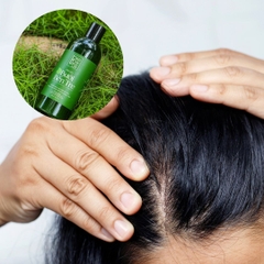 Da Đầu Nhờn Gội Hoài Vẫn Bết - Nguyên Nhân Từ Đâu?