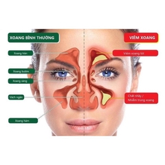 Nasal Hygiene Pray - Dr.D's Formula (Xịt xoang mũi)