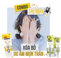 Set trị mụn 3 sản phẩm Acne Fast