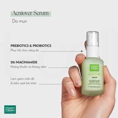 MartiDerm Acniover Serum - Tinh Chất Giảm Mụn & Kiểm Soát Nhờn