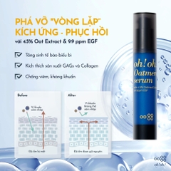 Tinh Chất Tế Bào Gốc, Tái Tạo Da Oh!Oh! Oatmere Serum