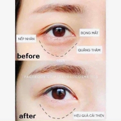Kem Dưỡng Mắt SK-II SkinPower Eye Cream