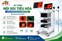 Hệ thống nội soi tiêu hóa có AI chẩn đoán