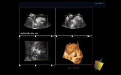 Máy siêu âm 4D cho động vật