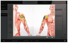 Máy điều trị sóng xung kích lan tỏa