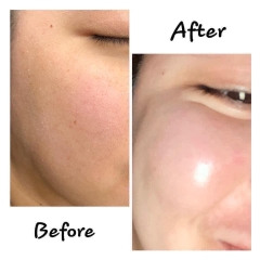 Tinh Chất Cấp Ẩm, Căng Bóng Sáng Da Serum SMAS HA Premium Ampoule