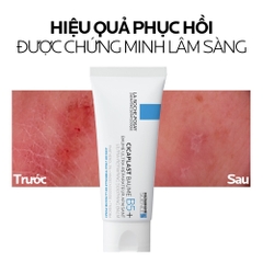 Kem Dưỡng Làm Dịu Phục Hồi Da La Roche-Posay Cicaplast Baume B5