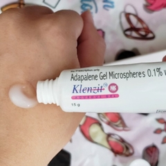 Chấm Mụn Glenmark Pharma  Klenzit Ms Adapalene