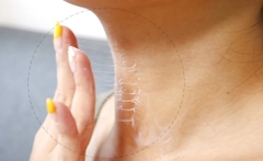 Kem Dưỡng Cổ Chống Lão Hóa,Giảm Nếp Nhăn Medi-Peel Naite Thread Neck Cream