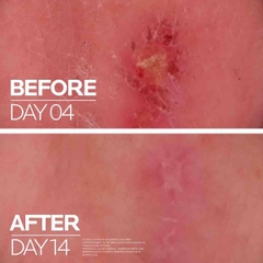 Kem Dưỡng Làm Dịu Phục Hồi Da La Roche-Posay Cicaplast Baume B5