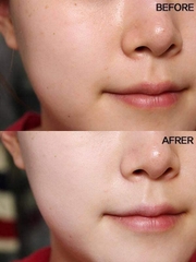 Kem Dưỡng OLAY Total Effects 7 in 1 Day Moisturiser Nourish Protect Vitamins C & B3