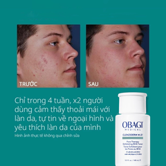 Tẩy Da Chết  BHA Obagi Clenziderm MD Pore Therapy