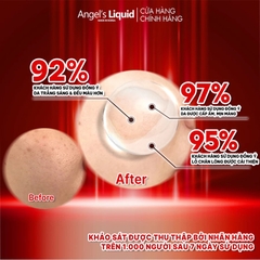 Serum Angel's Liquid Huyết Thanh Hỗ Trợ Dưỡng Trắng Da, Làm Mờ Thâm Nám Angel's Liquid Glutathione 700 V-Ampoule
