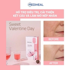Mặt Nạ Ngăn Ngừa Lão Hóa Da Mediheal Collagen Essential Mask 24ml (Hồng)