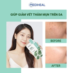 Mặt Nạ Mediheal Teatree Essential Mask Calming Làm Dịu Da, Kháng Khuẩn 24ml Madecassoside