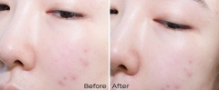 Tinh Chất Serum Dưỡng Trắng Da Mờ Thâm Nám Vitamin C Klairs Freshly Jucied Vitamin Drop