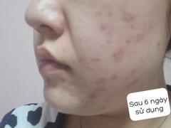 Tinh Chất Serum Skin1004 Madagascar Centella Asiatica 100 Ampoule