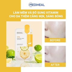 Mặt Nạ Dưỡng Trắng Da Mờ Thâm Mediheal Vita Essential Mask 24ml- Brightening (Vàng)